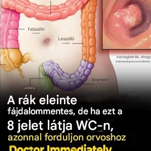 Mit árul el a székletürítés az egészségi állapotodról? 👇 Olvasd el a cikket 💬