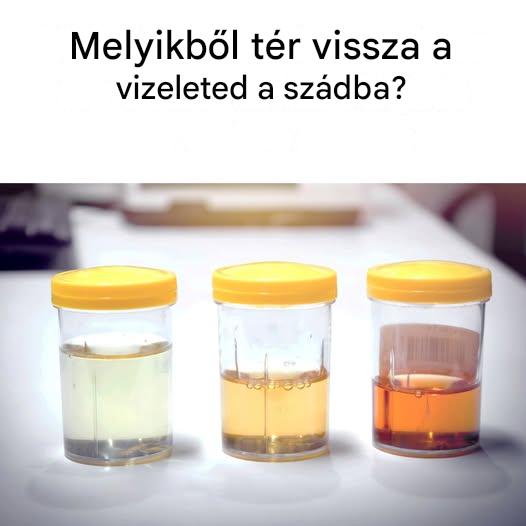 Íme, mit árul el a vizeleted színe az egészségi állapotodról