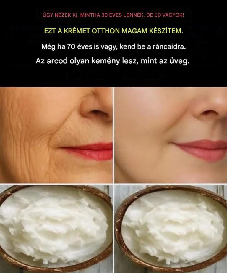 A nagynéném megtanított arra, hogyan készítsek saját házi krémet a ráncok és mitesszerek eltüntetésére.