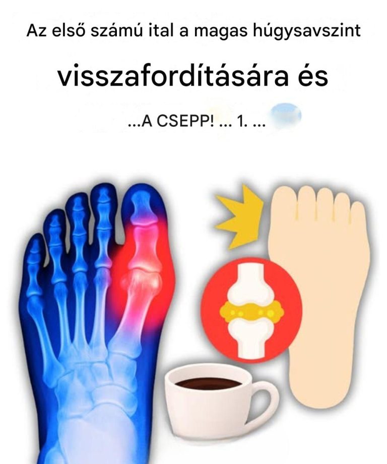 „Lángolt a nagylábujjam… amíg fel nem fedeztem ezt az 5 italt, ami természetes úton távolítja el a húgysavat!”
