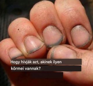 Hogy hívják azt, akinek ilyen körmei vannak?