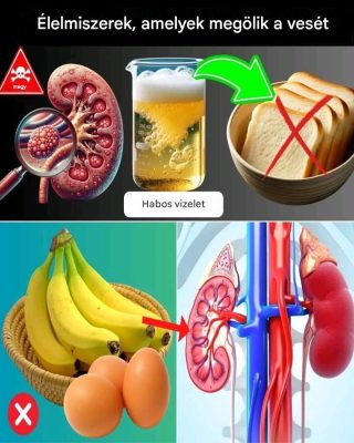Vese-egészségügyi útmutató: A proteinuria kezeléséhez korlátozandó élelmiszerek