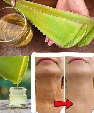 1000-szer hatékonyabb, mint a Botox! Természetes kollagén aloe verával!