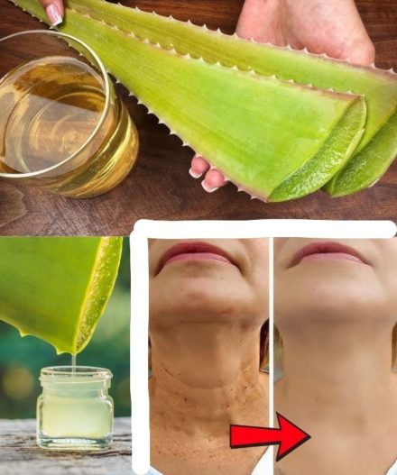 1000-szer hatékonyabb, mint a Botox! Természetes kollagén aloe verával!