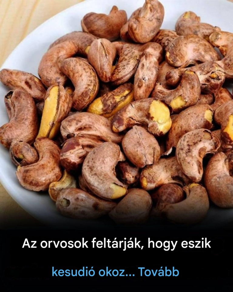 Az orvosok szerint a kesudió fogyasztása okozhat