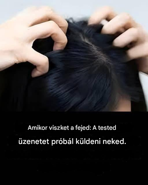 Viszkető fejbőr? Íme a fő okok.