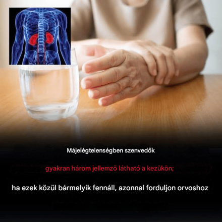 Miért kellene aggódnod, ha elalszik vagy elzsibbad a kezed?