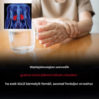 Miért kellene aggódnod, ha elalszik vagy elzsibbad a kezed?