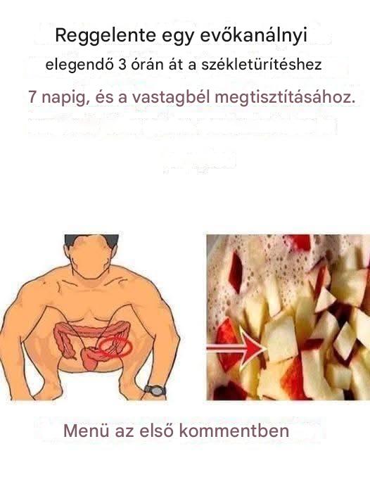 Székrekedés: Íme 3 természetes módszer a bélmozgások megkönnyítésére egy dietetikus szerint.