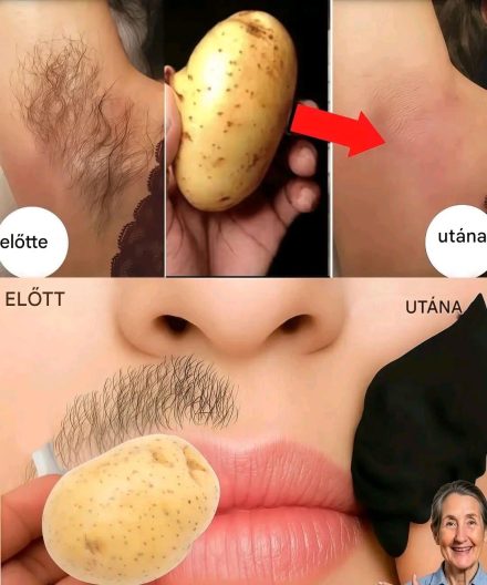 Hagyd abba a borotválkozást! Természetes módja a nem kívánt szőrszálak otthoni csökkentésének (fájdalom és vegyszerek nélkül)