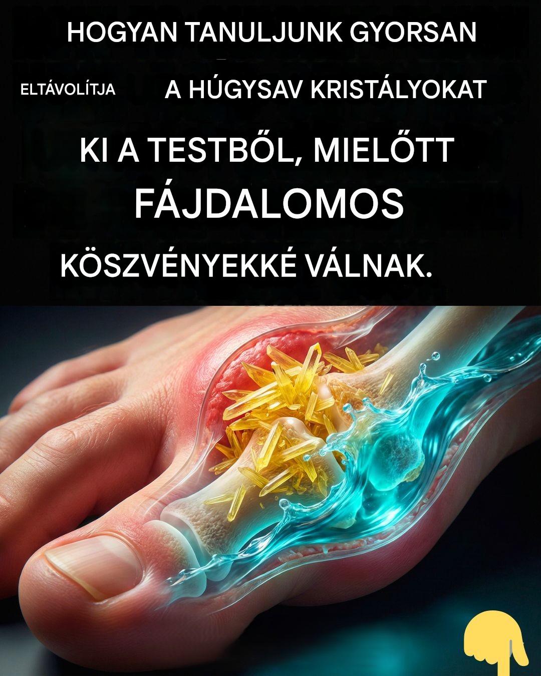 Hogyan távolítsuk el gyorsan a húgysavkristályokat a szervezetből a köszvény és az ízületi fájdalom megelőzése érdekében