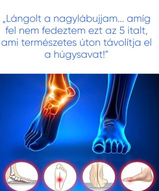 „Lángolt a nagylábujjam… amíg fel nem fedeztem ezt az 5 italt, ami természetes úton távolítja el a húgysavat!”