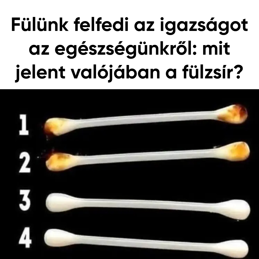 Fülünk felfedi az igazságot az egészségünkről: mit jelent valójában a fülzsír?