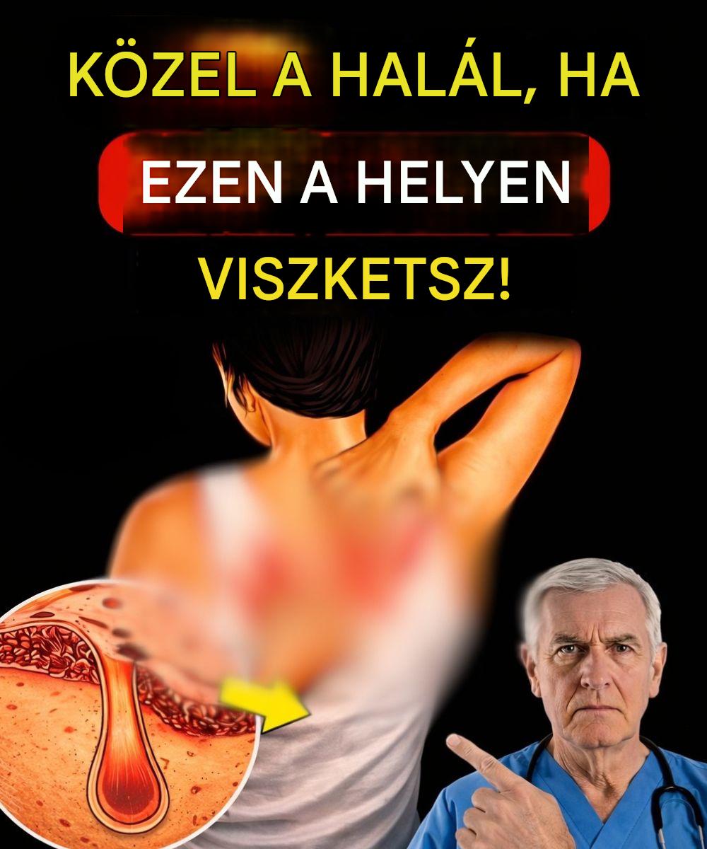 A test 3 olyan területe, ahol tartós viszketés jelentkezhet, ami figyelmeztető jel lehet, és nem szabad figyelmen kívül hagyni.