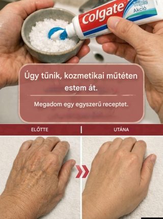 Hogyan javíthatja a fogkrém természetesen az öregségi foltok és ráncok megjelenését?