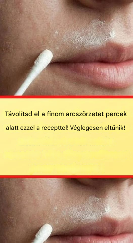 Ez a természetes recept lehetővé teszi az arcszőrzet végleges eltávolítását.