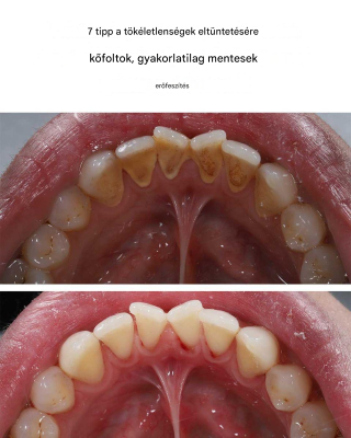7 tipp a kőből készült csúnya foltok egyszerű eltávolításához.