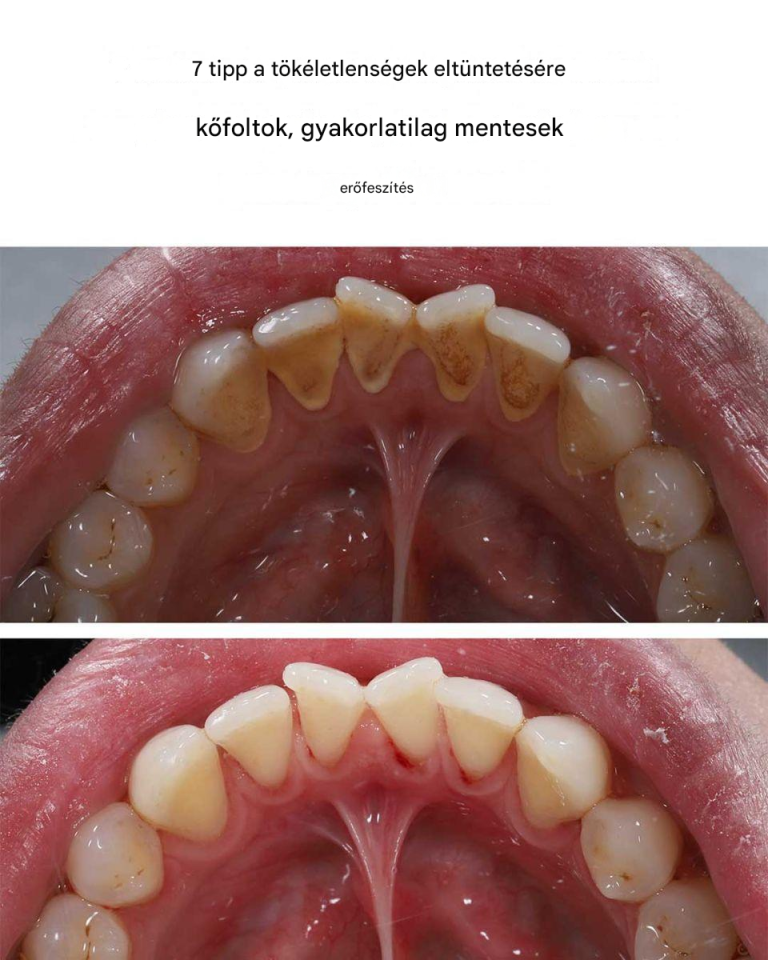 7 tipp a kőből készült csúnya foltok egyszerű eltávolításához.