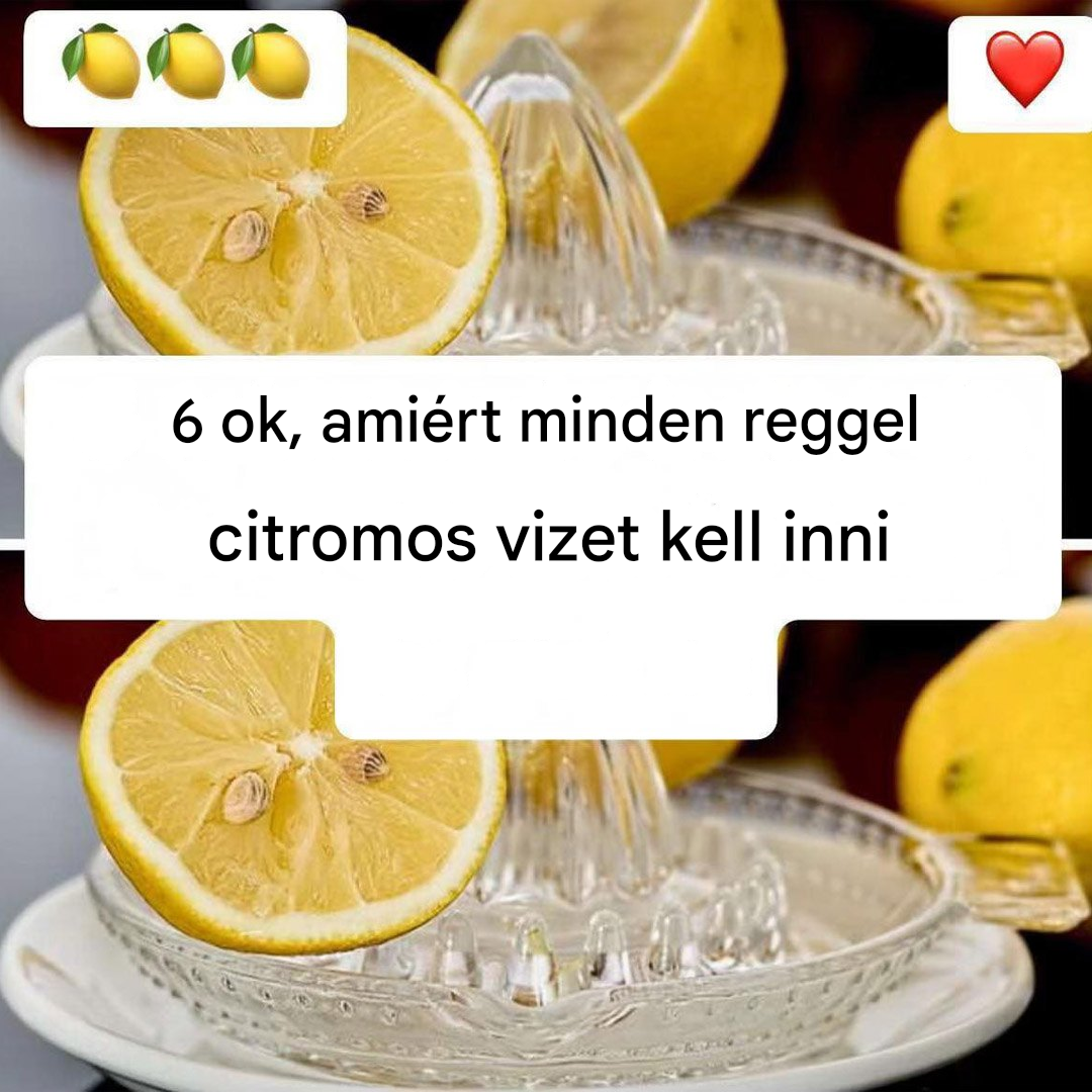 Miért igyunk meleg citromos vizet? Fedezd fel ezt a 6 okot!