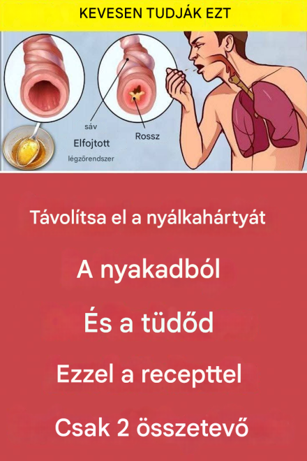 Tisztítsd meg a nyálkát a torkodból és a tüdődből ezzel a recepttel – mindössze 2 hozzávalóval