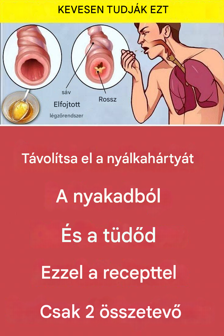 Tisztítsd meg a nyálkát a torkodból és a tüdődből ezzel a recepttel – mindössze 2 hozzávalóval