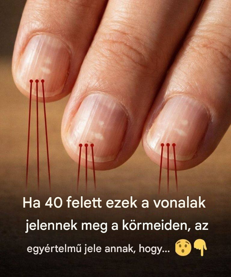 Ételek, amelyek erősítik a körmöket 40 év felett